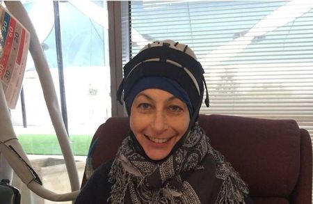Small linda scalp cooling 3